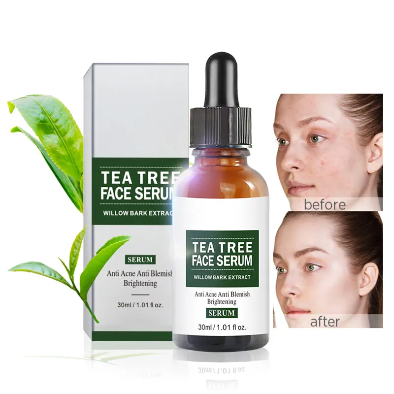 Ordinary Retinol Tea Tree Niacinamide 24K Gold Hyaluronic Acid Vitamin C Serum